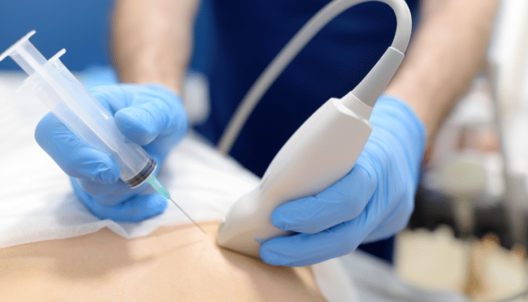 Cancer Biopsy Market