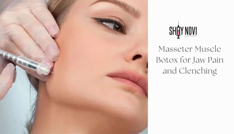 masseter muscle botox