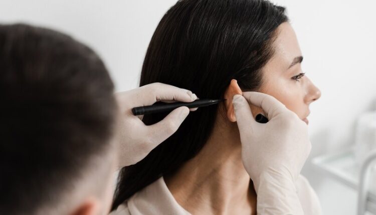 Otoplasty Surgery in Islamabad