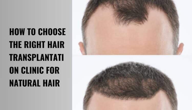 hair transplantation clinic