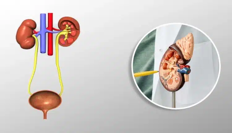 Best Urologist in Jaipur