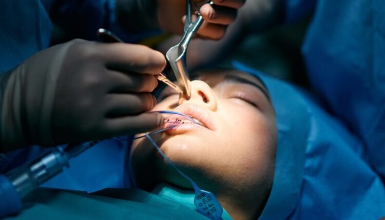 Best rhinoplasty surgeon in utah