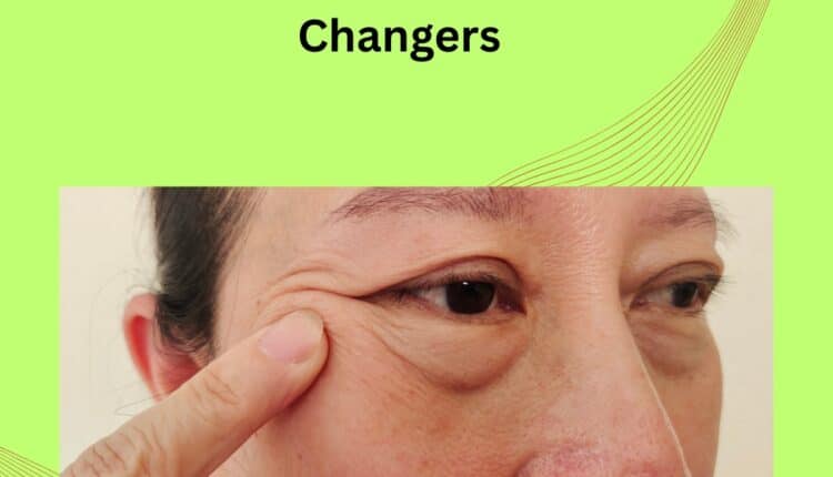 Dark Circles and Puffiness
