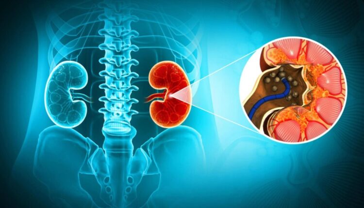Best Urologist in Jaipur