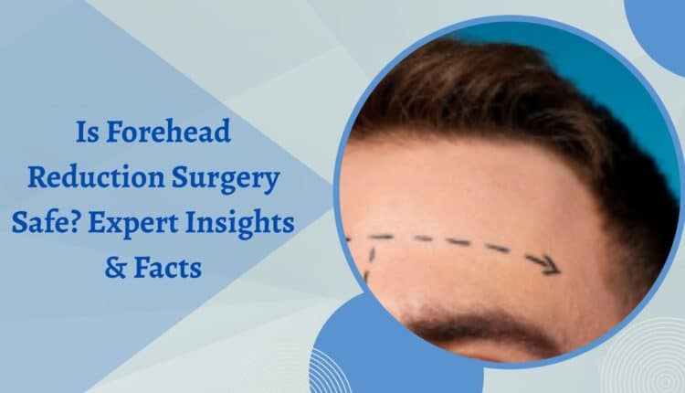 forehead-reduction-surgery