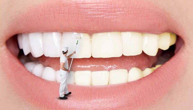 Remove Stains from Teeth