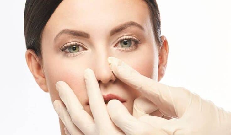 Rhinoplasty in Riyadh