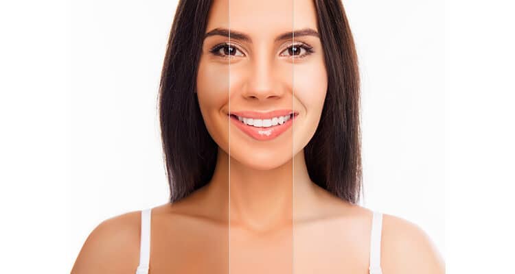 Skin whitening in Islamabad