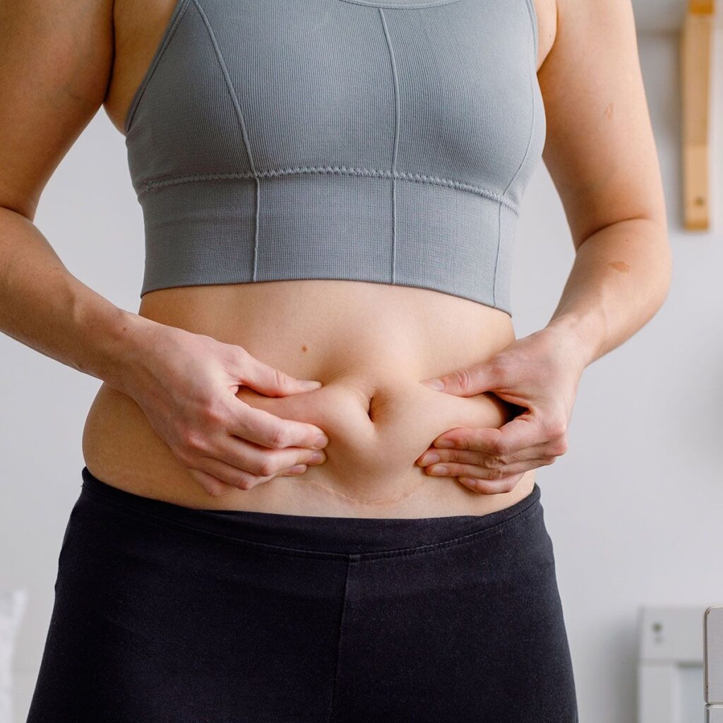 Tummy Tuck Surgery in Riyadh