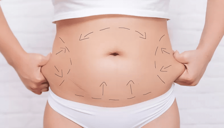 Tummy tuck consultation Islamabad