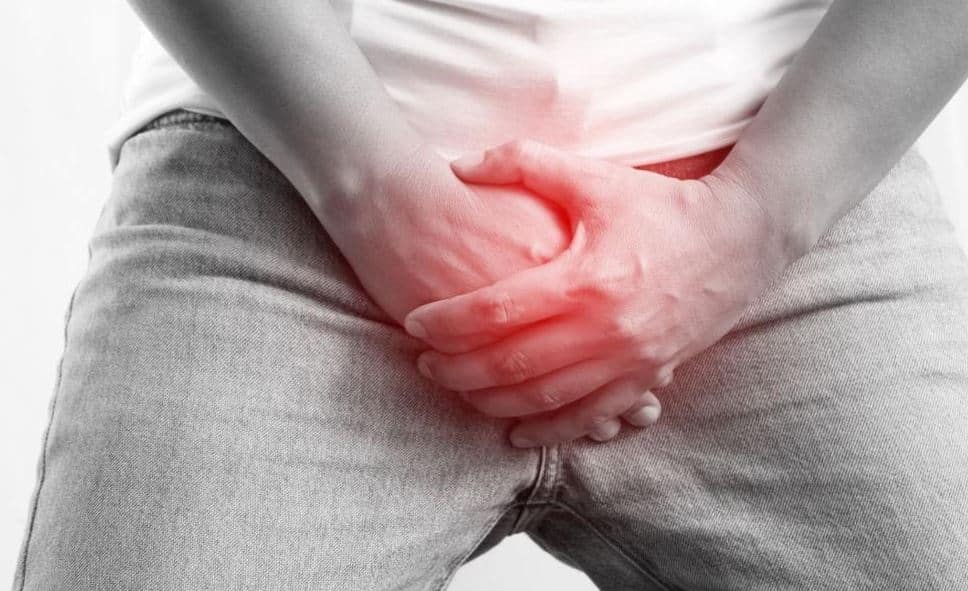 Varicocele