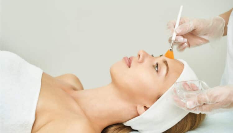 chemical peels in Islamabad