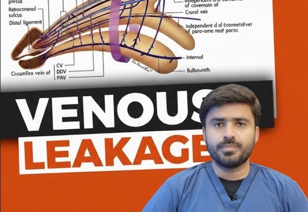 venous leak treatment